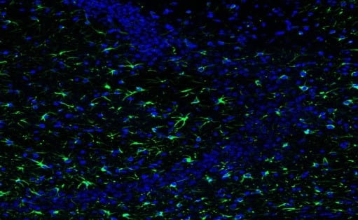 GFAP staining in the hippocampus
