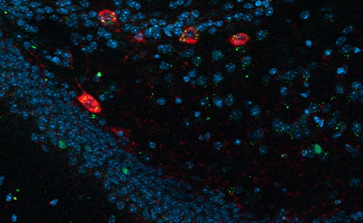 Dentate gyrus. PV positive interneurons (red), c-Fos activation (green)